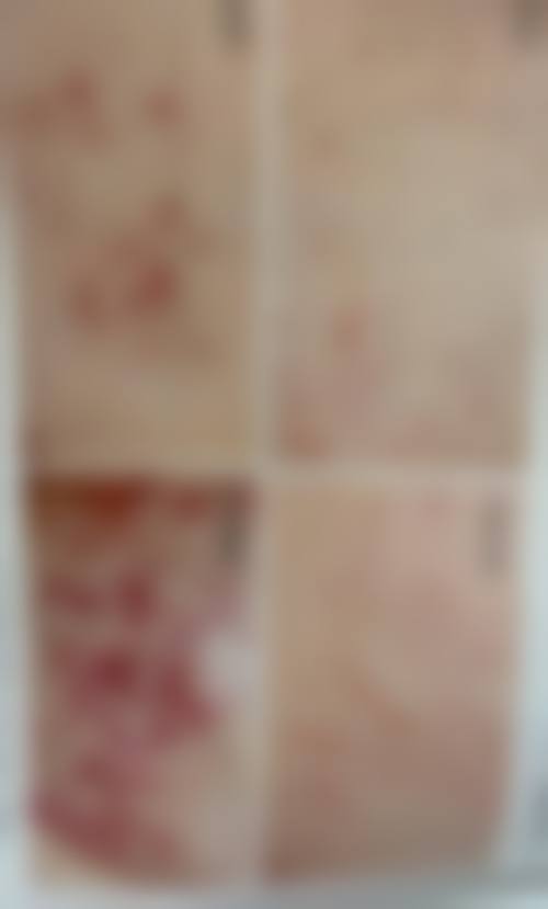 毕节市中医院来院路线