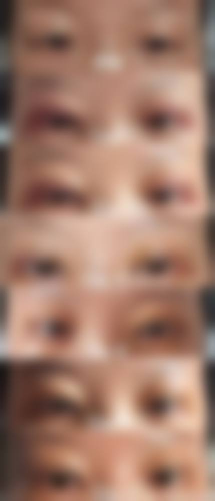 预约权俸轼院长诊疗的方式