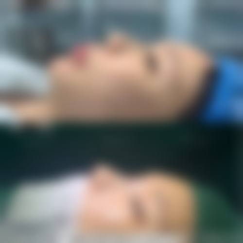武汉兰天医学整形美容医院价格收费