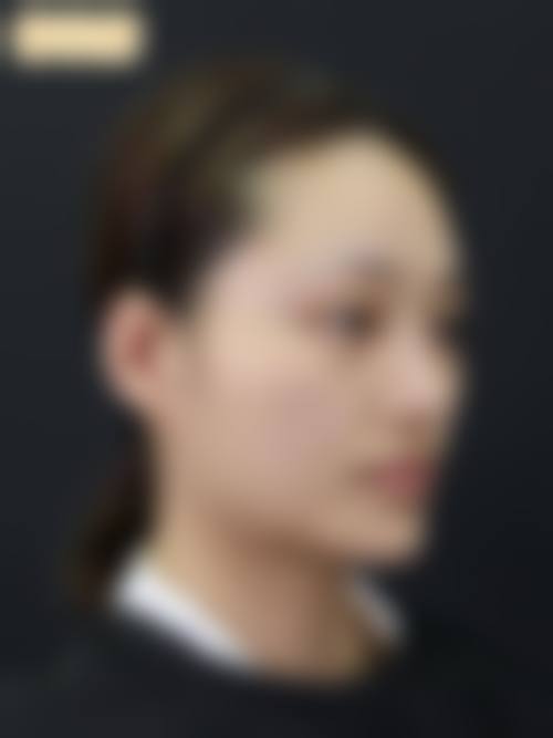 哈尔滨市第五医院(烧伤三病区（整形美容科）)价格收费