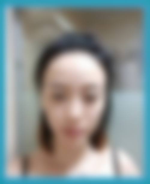 韩国姿色zises整形医院价格收费