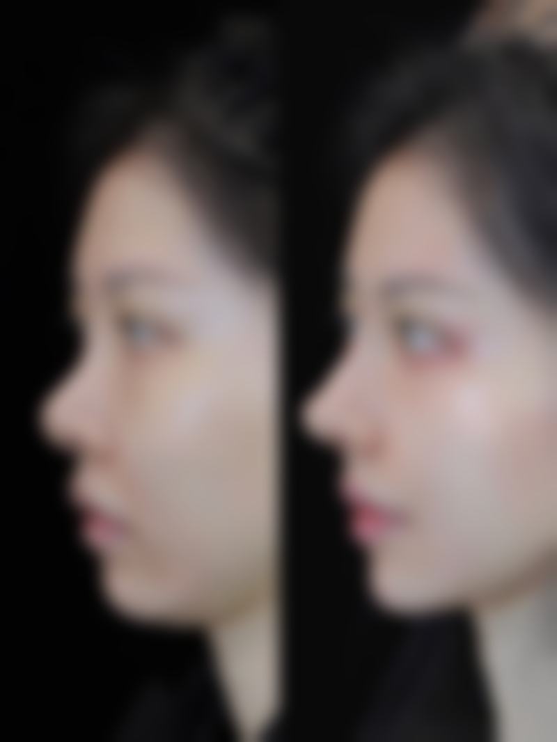 武汉兰天医学整形美容医院特色项目及技术优势