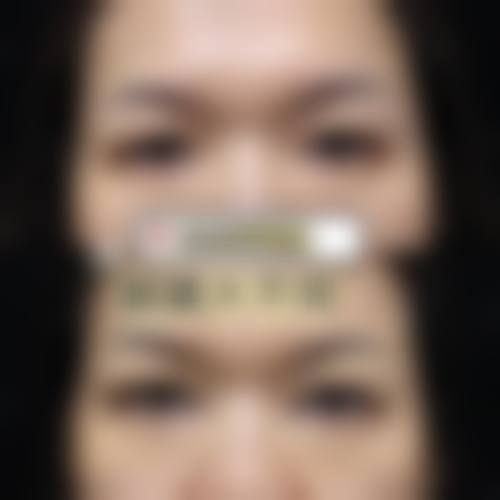 唐山颜月集医疗美容诊所求美者反馈