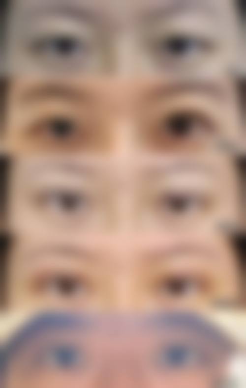 一美丽人医疗整形（二七总院）求美者反馈