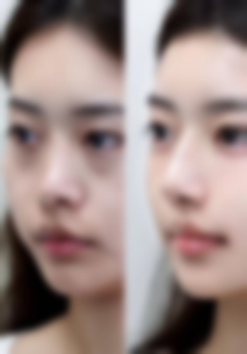 宋东明的个性化医美定制思路