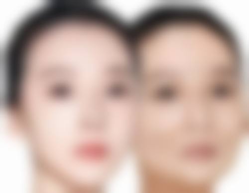成都美丽部落医疗整形美容诊所求美者反馈