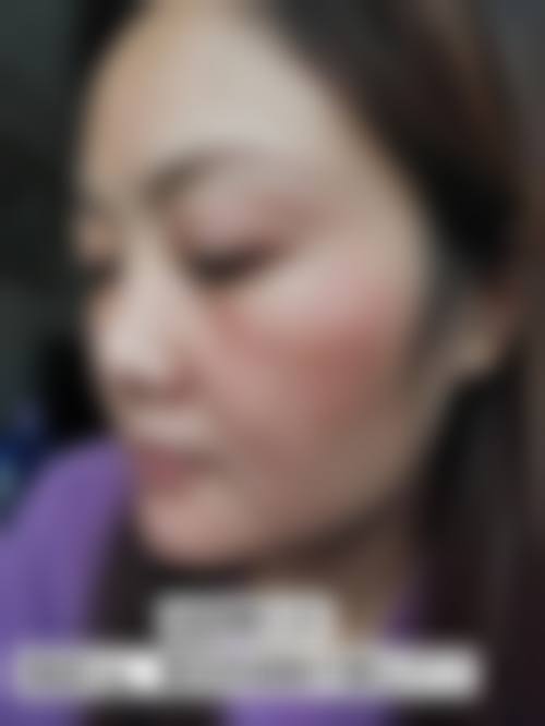 邓婷方医生的个性化医美服务理念