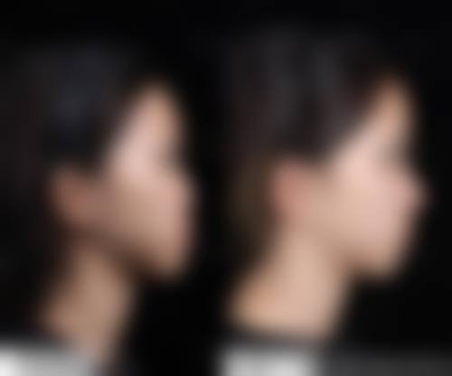 南昌姬妍整形医院求美者反馈