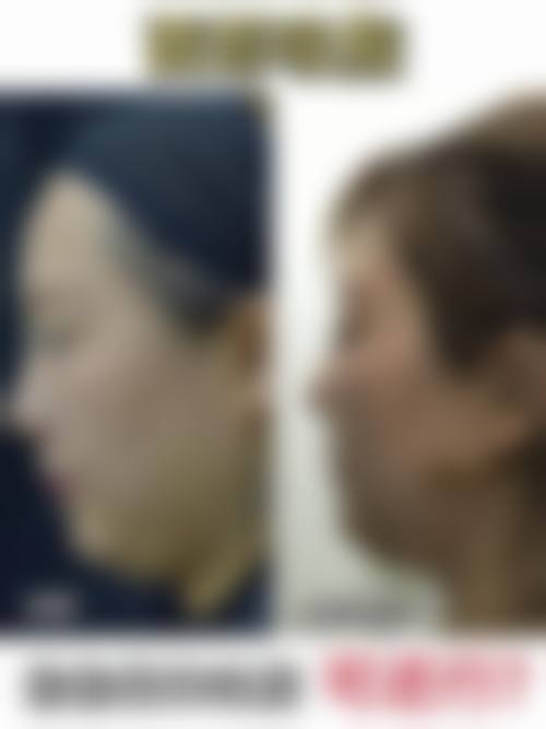 南昌姬妍整形医院来院路线