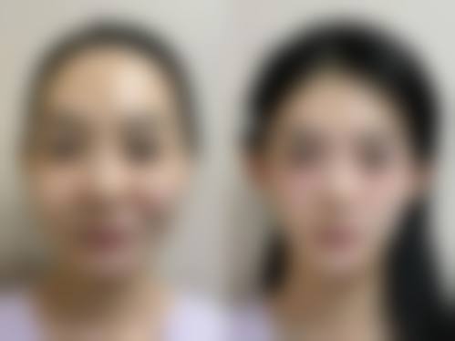 邓婷方医生：便捷的预约与面诊询问渠道