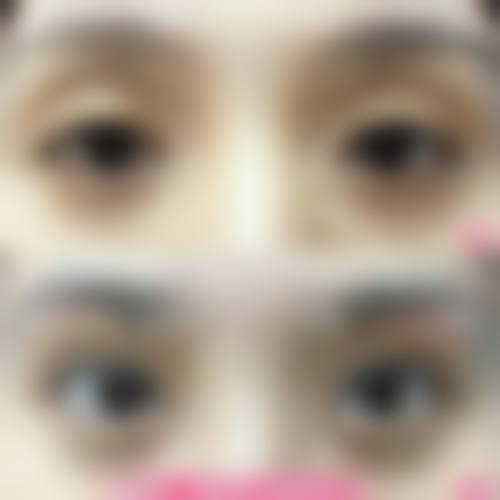 上饶信州双博医疗美容整形医院价格收费