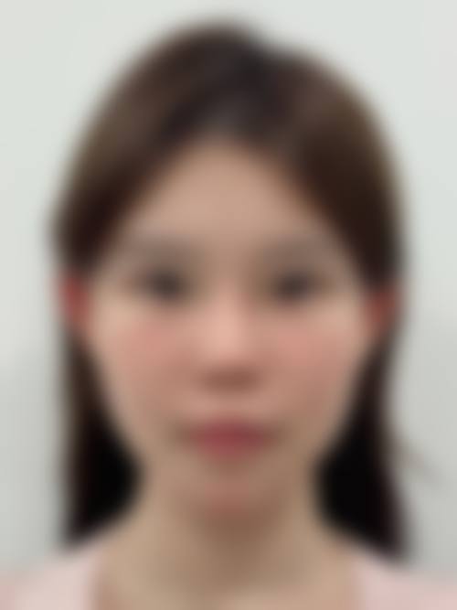 复旦大学附属眼耳鼻喉科医院(眼耳鼻整形外科)价格收费