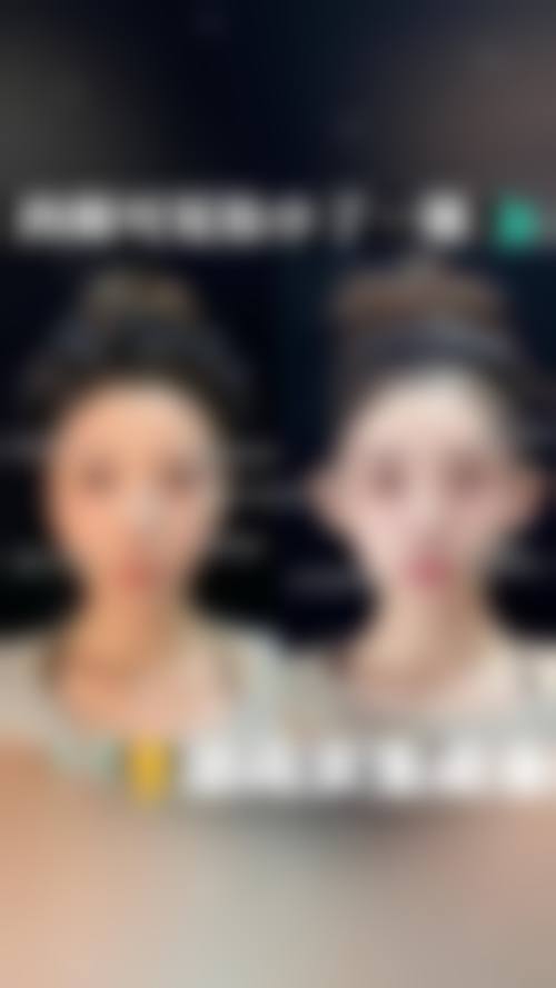 复旦大学附属眼耳鼻喉科医院(眼耳鼻整形外科)医生团队实力