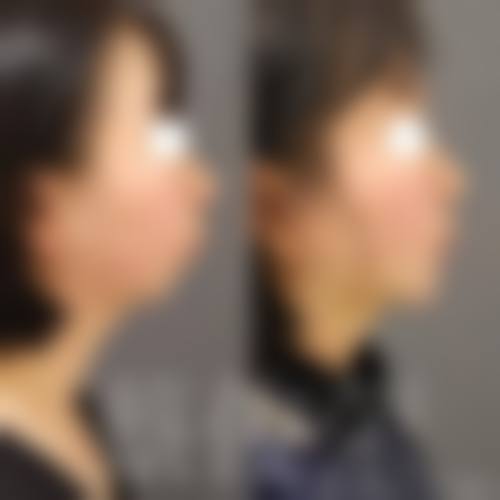 阜阳伊莱美医疗美容门诊部求美者反馈