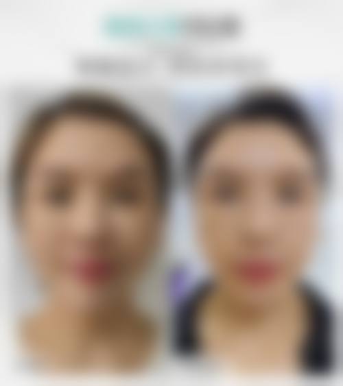 沈阳椤迪特医学美容诊所价格收费