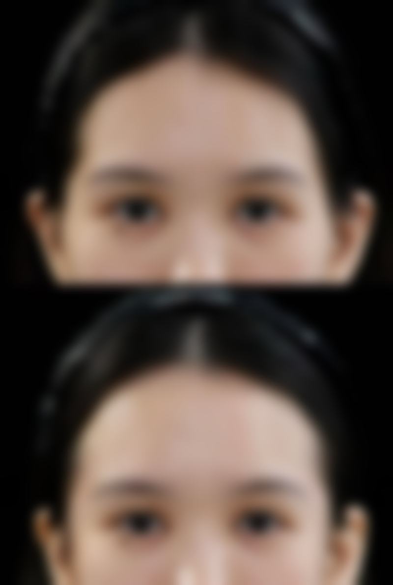 复旦大学附属眼耳鼻喉科医院(眼耳鼻整形外科)求美者反馈