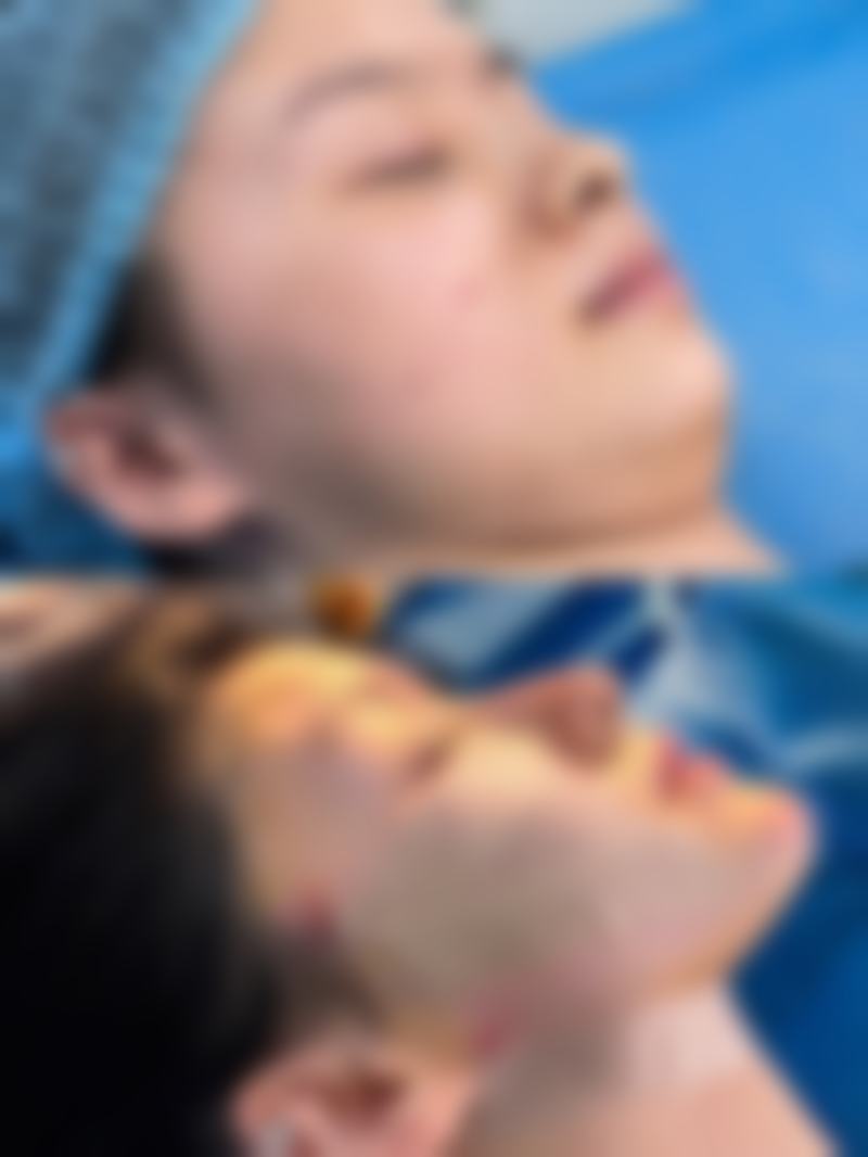 廊坊唯爱可依整形医院价格收费