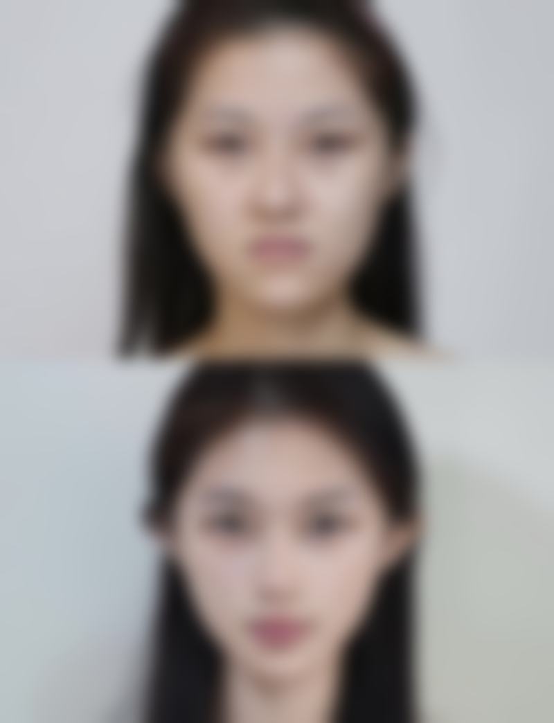 珠海市吉大艾贝尔整形美容医院求美者反馈