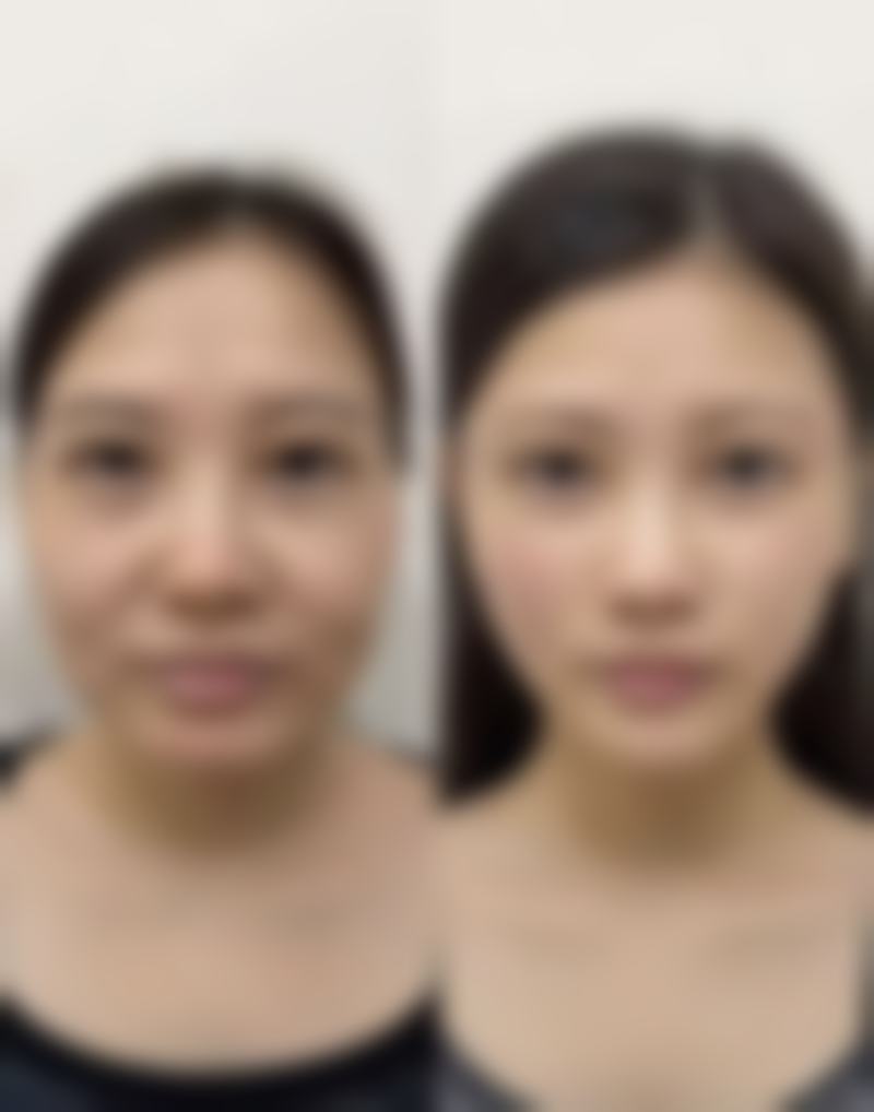 沈阳韩秀宫（国内外）整形美容连锁机构求美者反馈