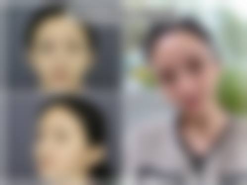 温州玉尚美医疗美容南白象整形外科门诊部特色项目及技术优势