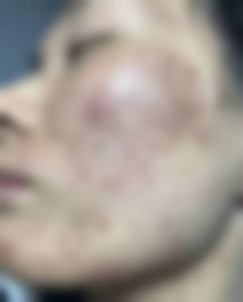 橡皮皮肤科价格收费