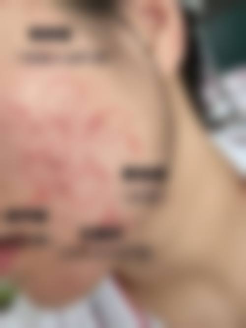 南宁芳间医疗美容诊所求美者反馈