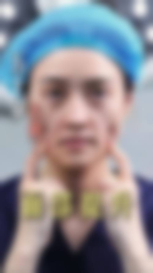肇庆圣蔻整形医院求美者反馈