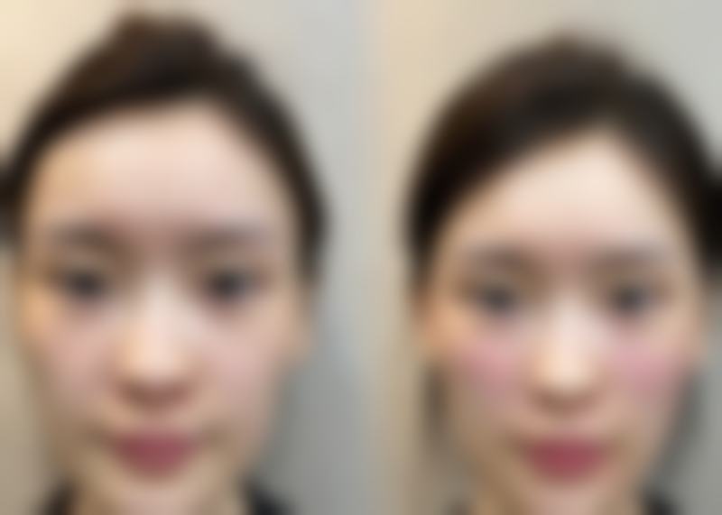 武汉佐登微尔医疗美容门诊部求美者反馈