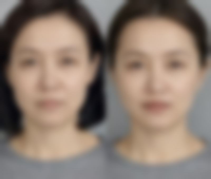 武汉佐登微尔医疗美容门诊部价格收费