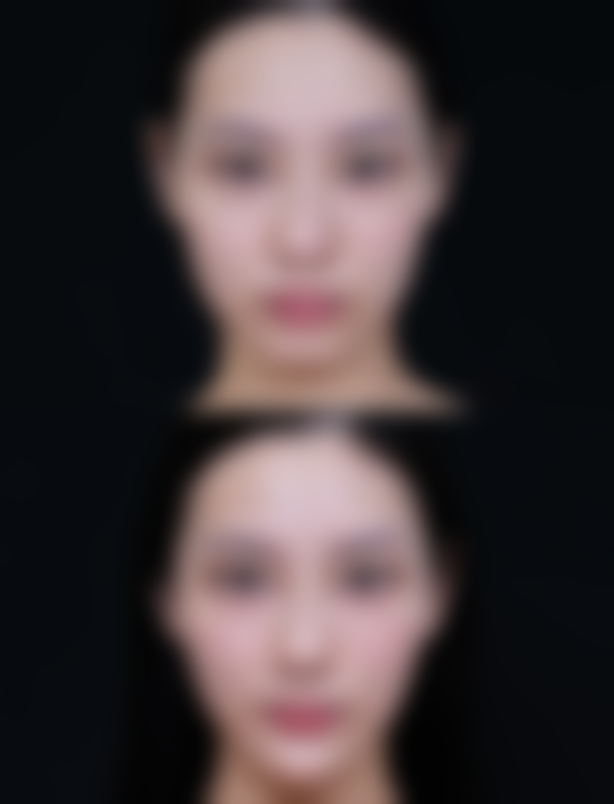 杰医德jade整形医院求美者反馈