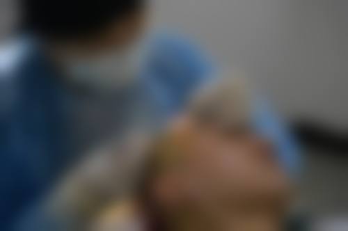 广州番禺区雍禾史云逊植发医院价格收费