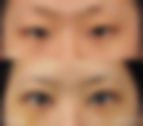 南方医 科 大学附属广州燕岭医院整形美容中 心求美者反馈