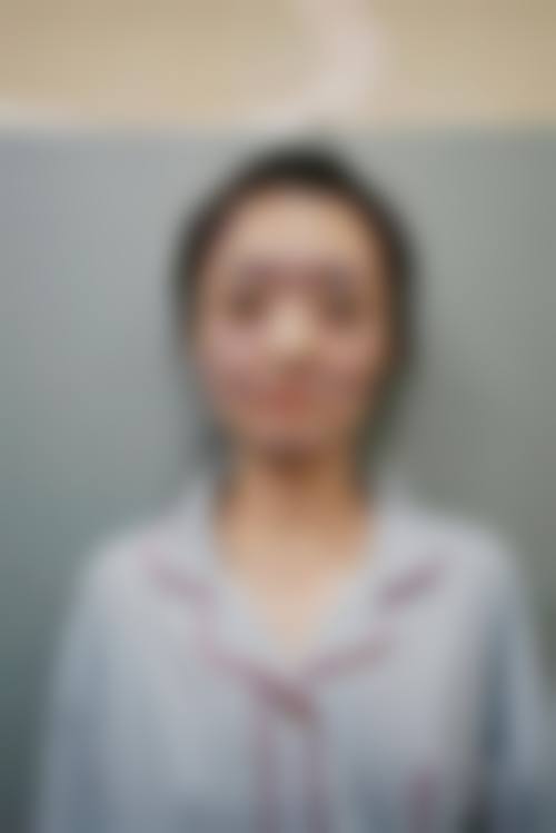 韩国德新整形外科医院价格收费