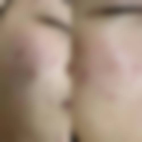 贵阳璀璨华光医疗美容诊所价格收费