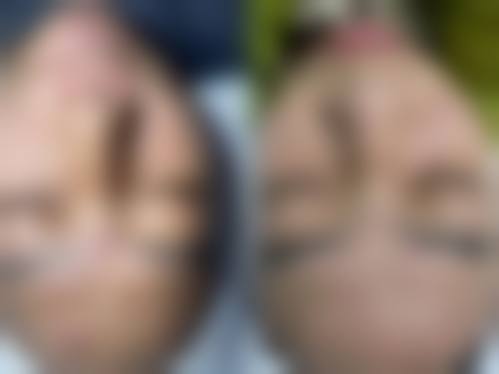 贵阳璀璨华光医疗美容诊所求美者反馈