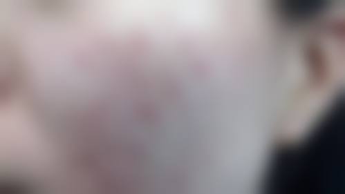 南京肤康皮肤病门诊部特色项目及技术优势
