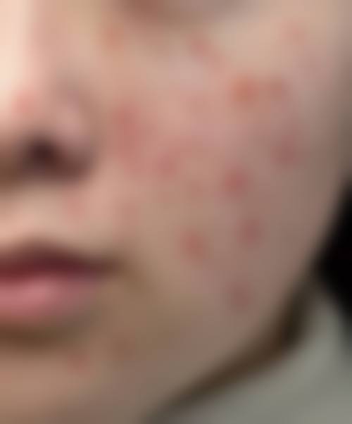 南京肤康皮肤病门诊部来院路线