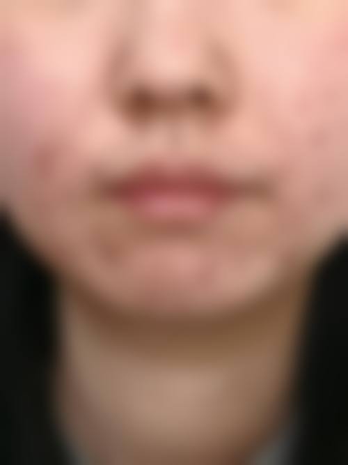 南京肤康皮肤病门诊部求美者反馈