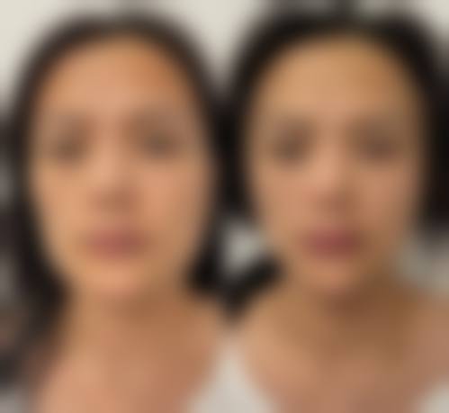 温岭善美医疗美容门诊部价格收费