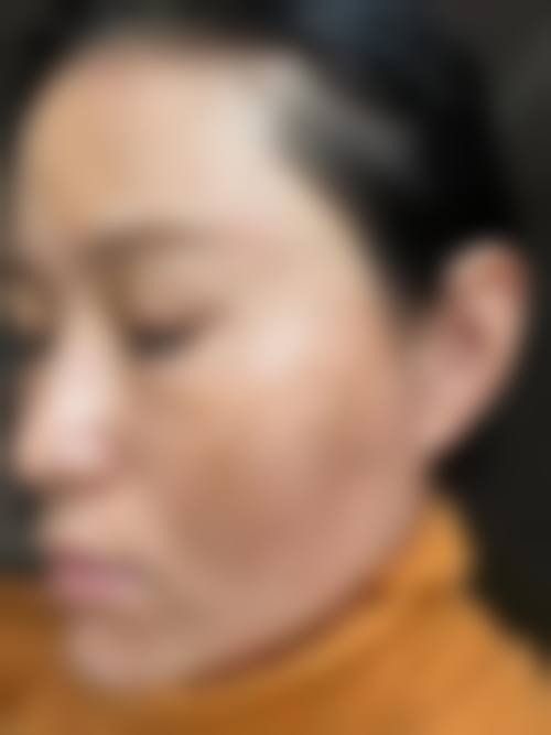陈艳芳医生的特色诊疗技术优势