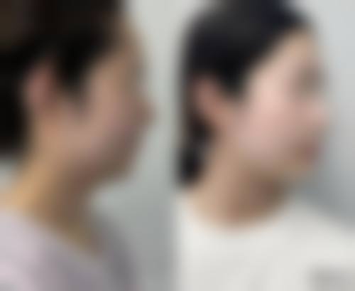 阆中亿美熹亚整形医院价格收费