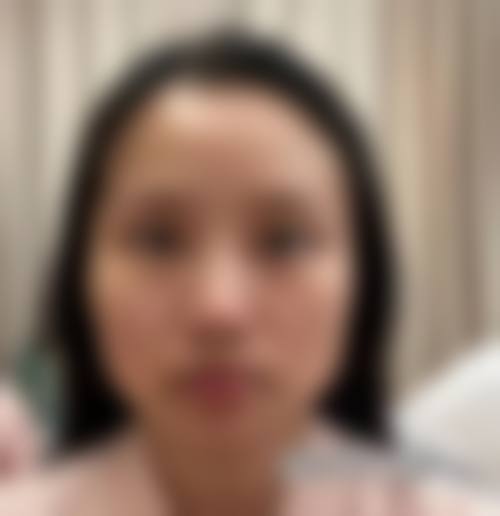 何伦的特色医美项目，覆盖全品类美丽需求