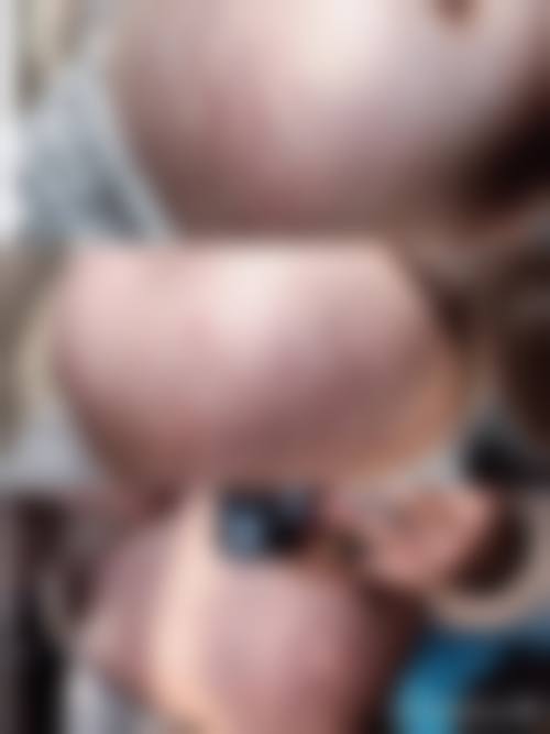 郑州明眸艺术整形医院求美者反馈