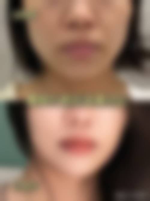 南京大西整形医院价格收费