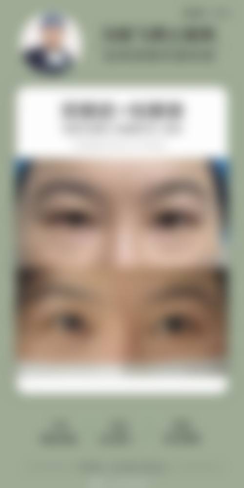 哈尔滨伊美尔医疗美容整形医院价格收费