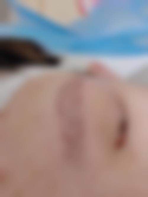 新疆维吾尔自治区职业病医院(整形烧伤科)特色项目及技术优势