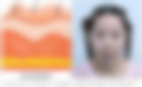 贵阳和美妇产医院整形美容中 心特色项目及技术优势