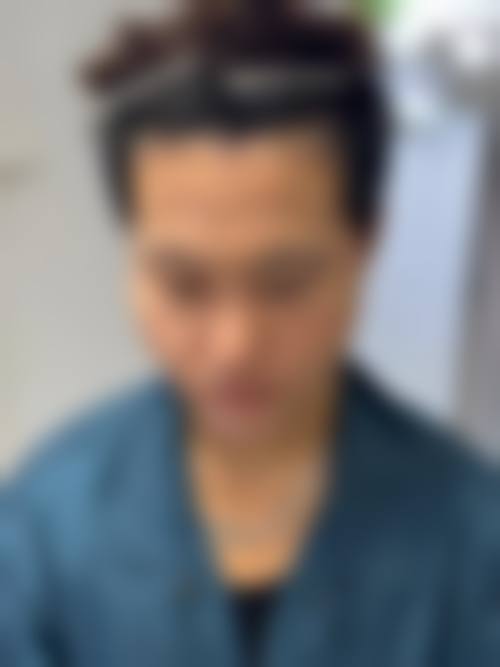 锦州福际植发中医院价格收费
