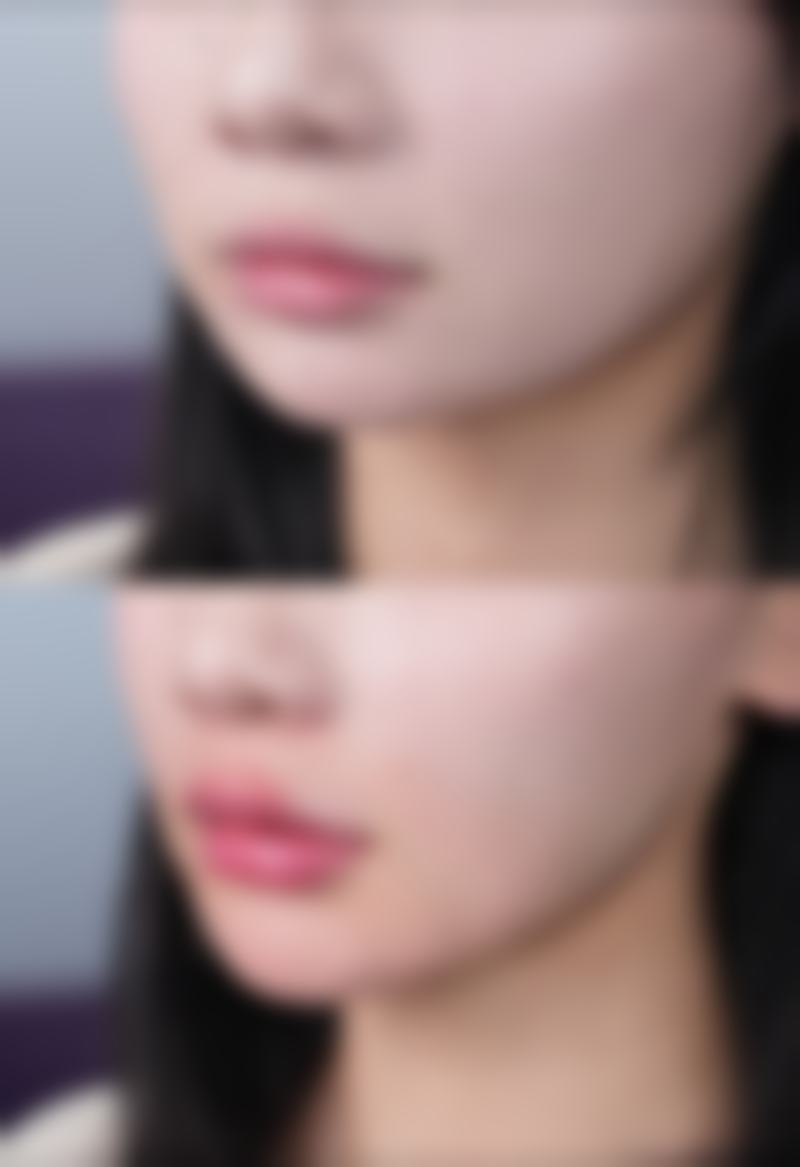 资阳北辰妇产医院价格收费