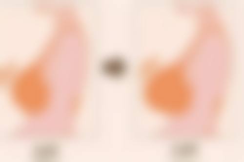 天津市第五中 心医院求美者反馈